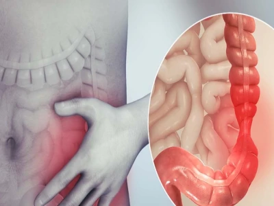 Triệu chứng nhận biết viêm đại tràng và cách khắc phục hiệu quả