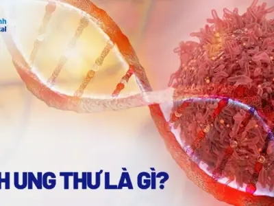 Ung thư là bệnh gì? Hiểu rõ nguyên nhân và cách phòng ngừa hiệu quả